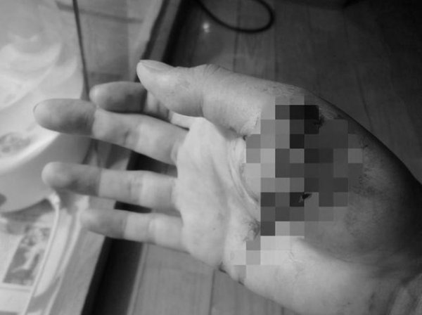 野鸡脖子真的存在吗