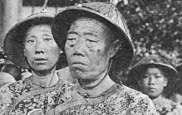 古代小太监净身介绍