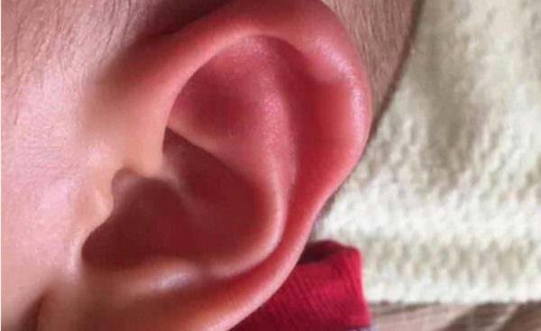 右耳朵发热的民间说法