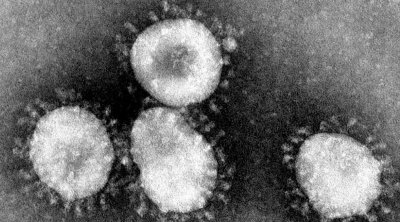 病毒存在多少亿年了 病毒在地球上有40亿年历史了