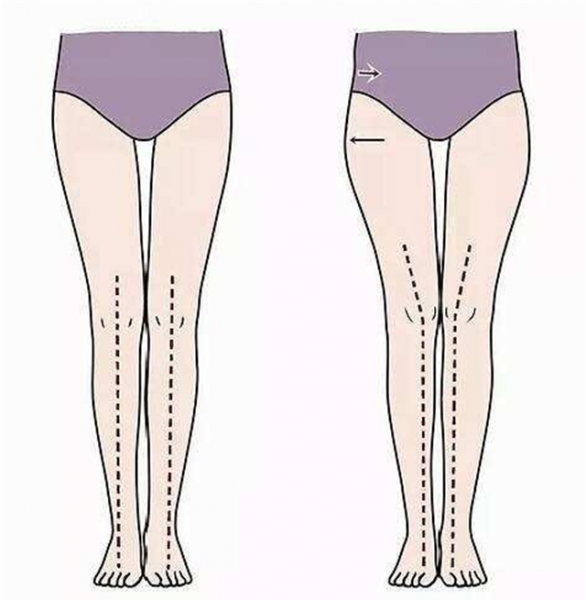 屁股大的女生怎么穿衣搭配