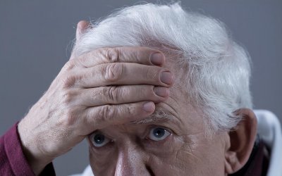 发际线多少厘米才算高 发际线怎么判断算正常范围