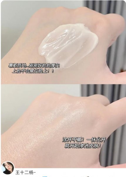 过敏肌肤用什么护肤品比较好