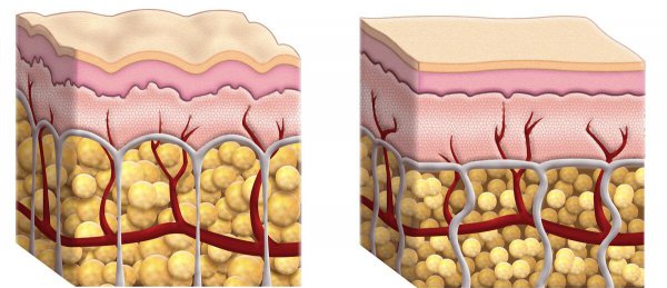 什么油好吃又健康性价比高
