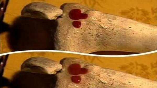 古时候滴血认亲原理