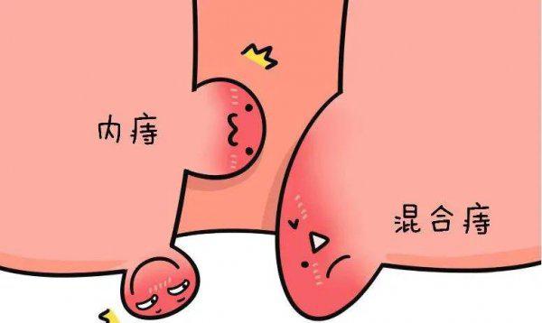 哪三种人不能吃鸽子