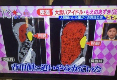 催吐是什么意思 用催吐的方式减肥对身体伤害有多大