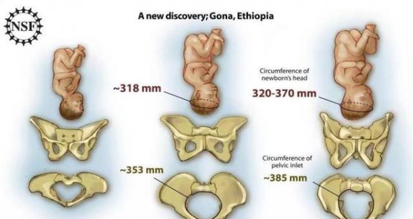 人类生理结构不合理的地方