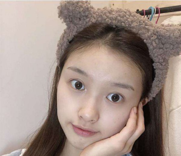 片仔癀珍珠膏的正确用法