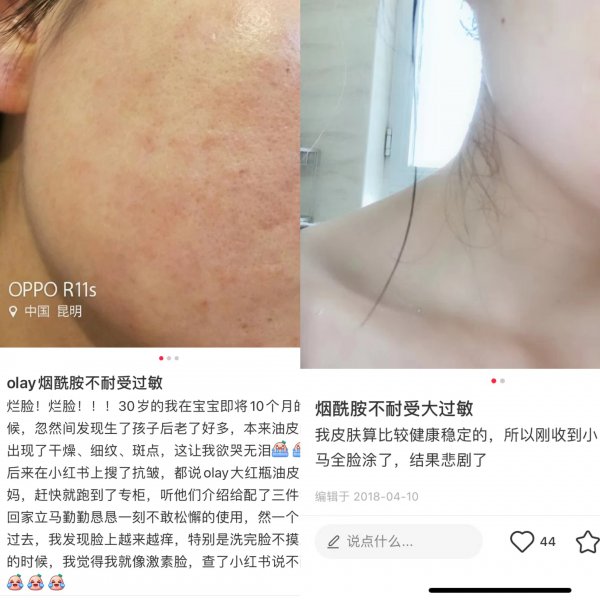 片仔癀珍珠膏的正确用法