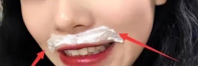 女生胡子能不能刮掉 女性嘴唇上长“小胡子”别乱刮