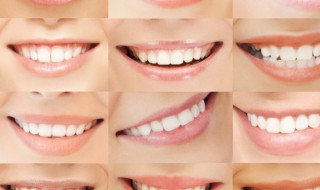 在家里洗牙有妙招 如何自己在家洗牙