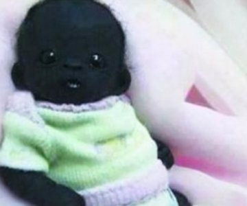 世界上最黑的是谁 世界上最黑的孩子现在怎么样了