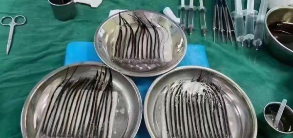 额头高发际线高适合什么刘海