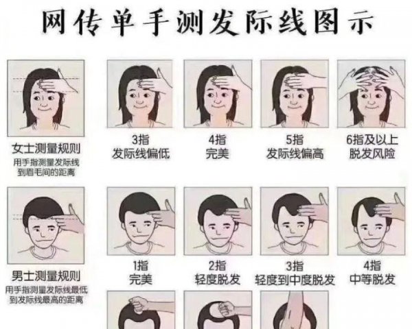 额头高发际线高适合什么刘海