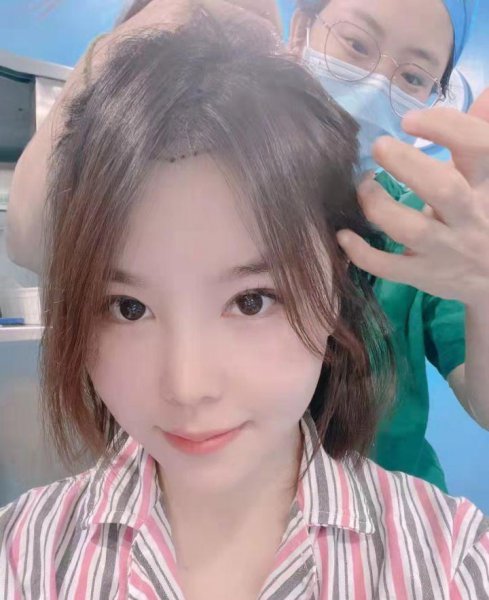 额头高发际线高适合什么刘海