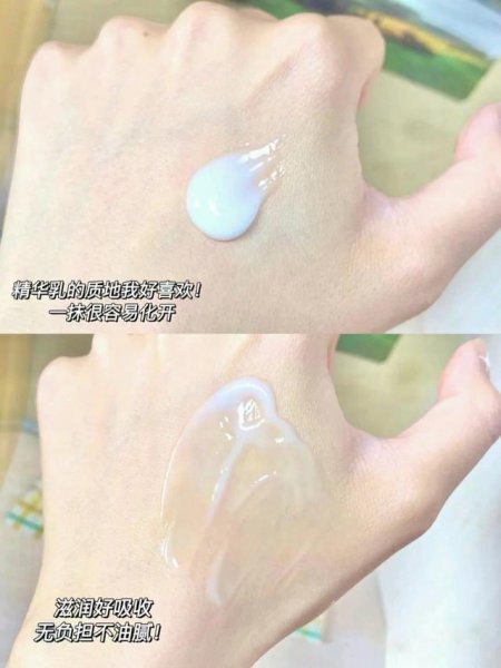 最适合油性皮肤排行榜护肤套装