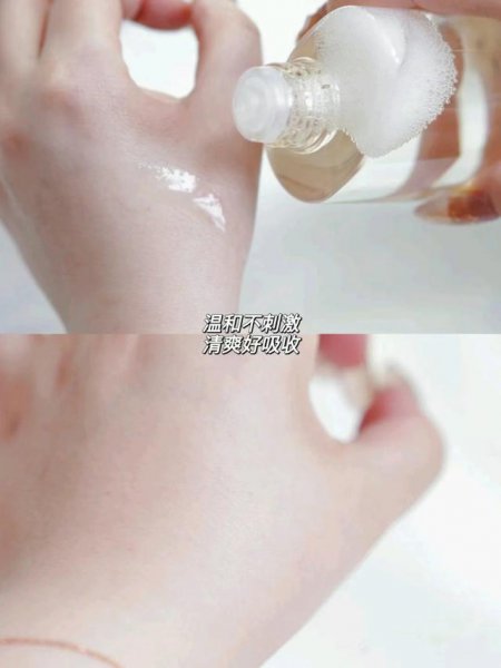 最适合油性皮肤排行榜护肤套装