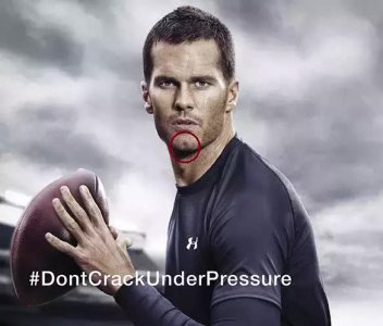 下巴的美人沟是什么意思 美人沟下巴的人很少吗