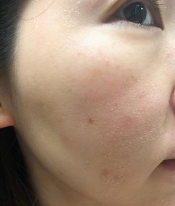 为什么会卡粉浮粉起皮 化妆后脸上卡粉浮粉怎么补救