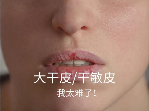 敏感肌适合用什么护肤品