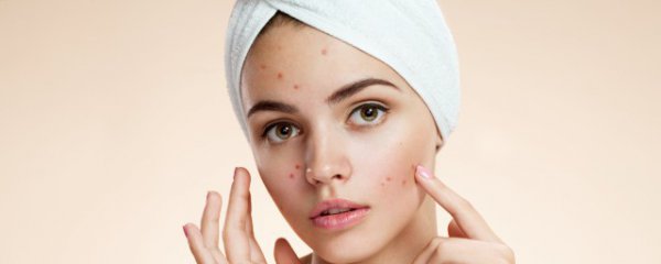 梦见脸上有痘是什么意思