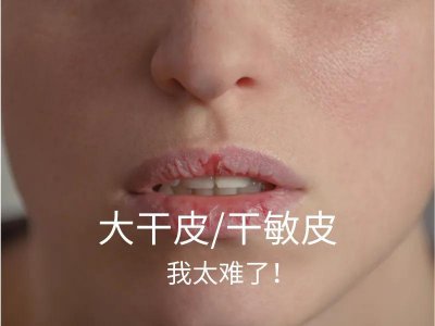 敏感肌适合用什么护肤品 什么护肤品好用又实惠排名