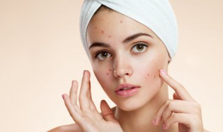 梦见脸上有痘是什么意思 梦见脸上有痘代表啥意思呢