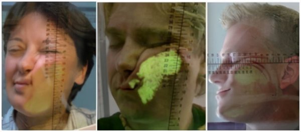 如何提高做春梦的几率