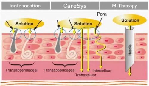 先水后乳和先乳后水的区别