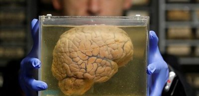 人死后24小时脑神经还活着吗 人死后脑子还活多久