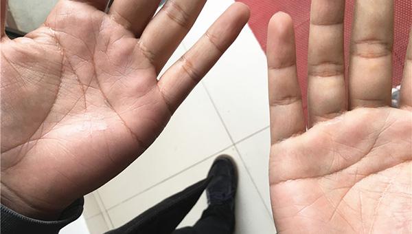 嫁给断掌的男人好不好