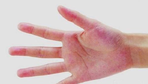 嫁给断掌的男人好不好