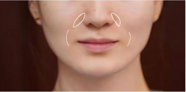 面部做什么动作可以消除法令纹