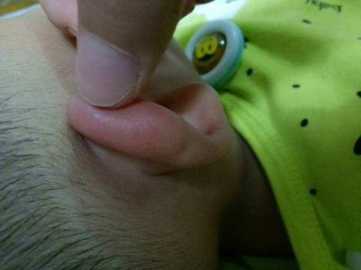 耳朵上有个小眼有福气 为何新生宝宝耳朵上会有小洞
