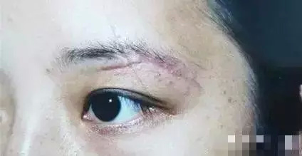 从风水上说女人纹眉好不好