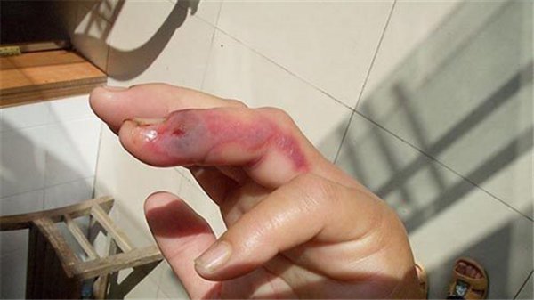 蜈蚣最害怕什么动物