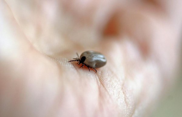 蜱虫长什么样子图片