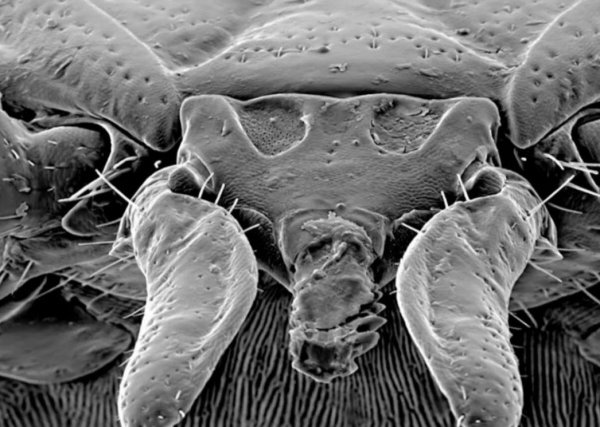 蜱虫长什么样子图片