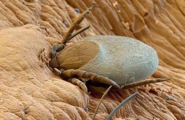 蜱虫长什么样子图片