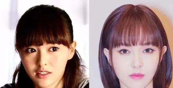 额头高适合什么发型