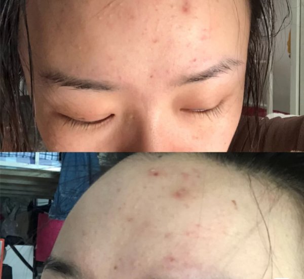 水疗是什么项目有何作用