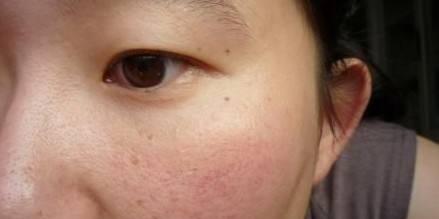 洗面奶里面含有什么成分不好