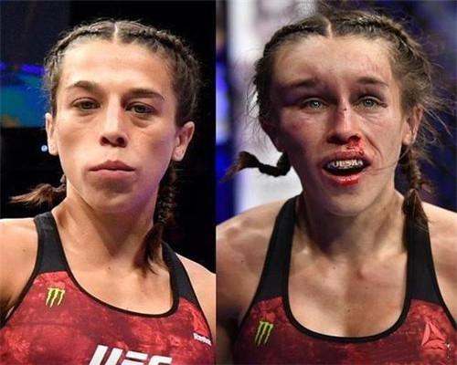 ufc有没有打死过人