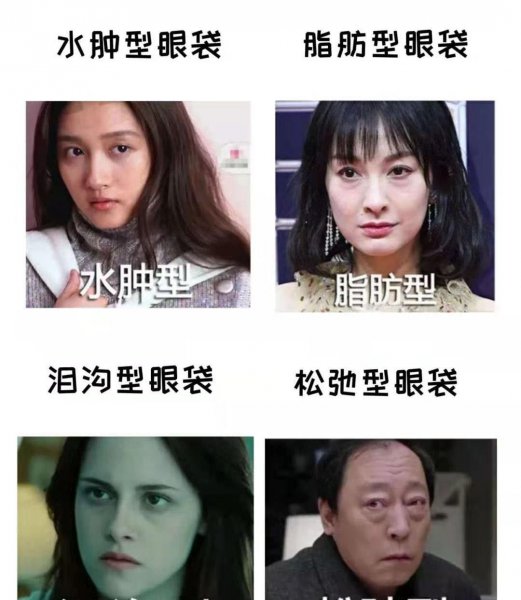 太实用了有了眼袋不用愁