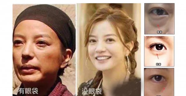 太实用了有了眼袋不用愁