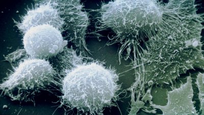 海拉细胞是什么 人体中的海拉细胞真的会长生不死吗