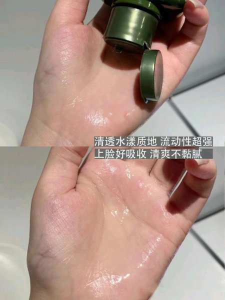 油性皮肤用什么牌子护肤品比较好用一点