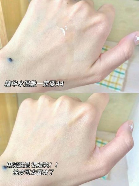 油性皮肤用什么牌子护肤品比较好用一点