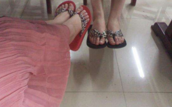 穿拖鞋脚为什么酸臭